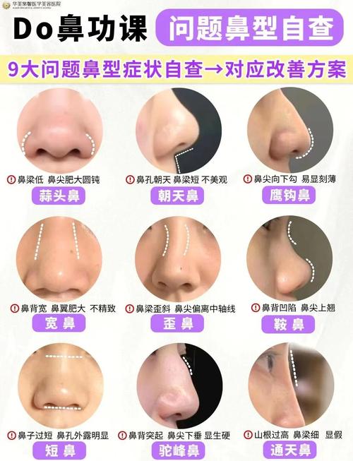 目前比较安全的隆鼻方法