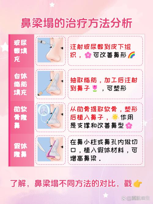 目前比较安全的隆鼻方法