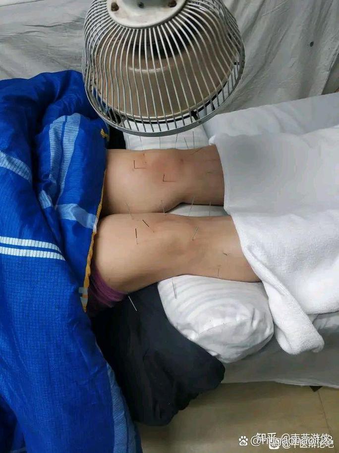 灵枢针灸治疗膝关节痛