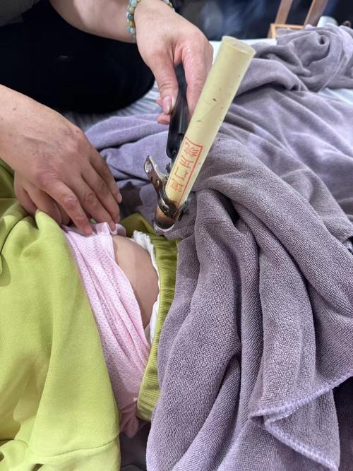 间质性肺炎可以针灸吗