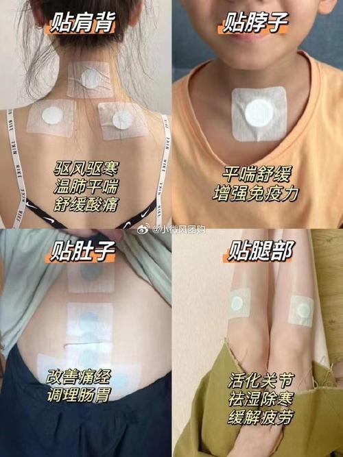 瘦针灸贴的位置示意图