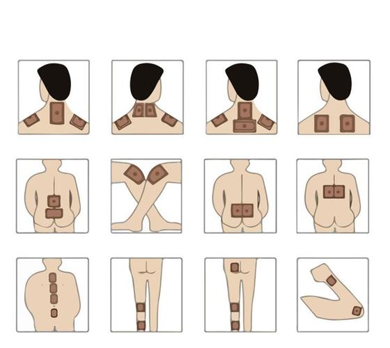 瘦针灸贴的位置示意图