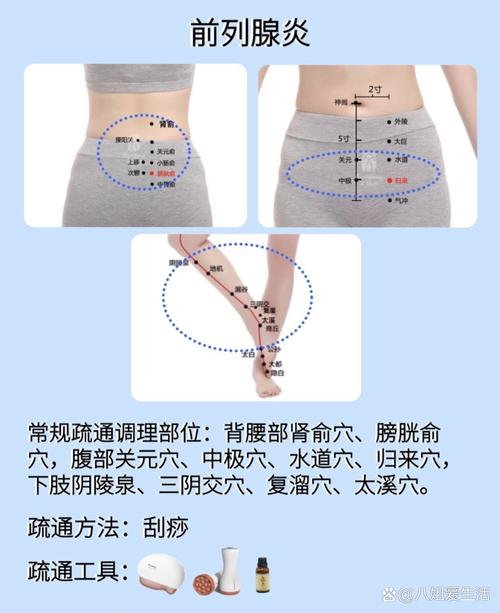 前列腺炎针灸哪些穴位