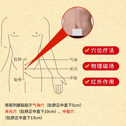 前列腺炎针灸哪些穴位