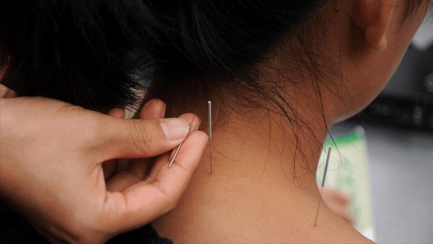 交感神经型颈椎病针灸