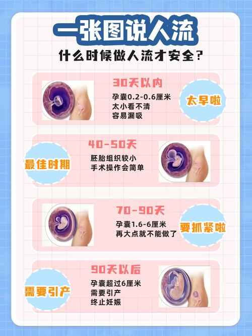 什么时候做无痛人流安全