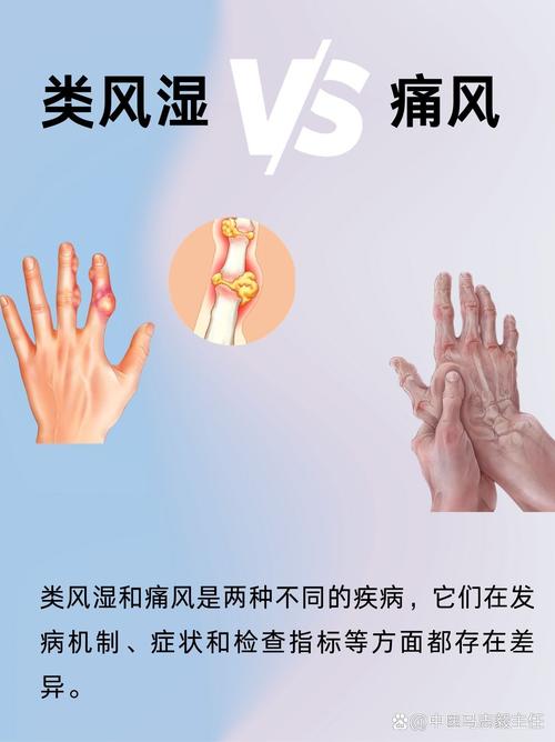 风湿痛和痛风痛的区别