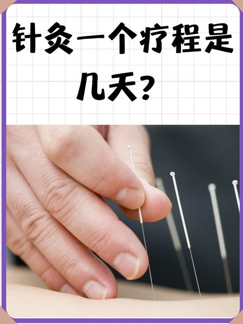 针灸每次需要多长时间