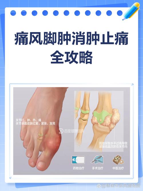 痛风消肿痒是怎么会事