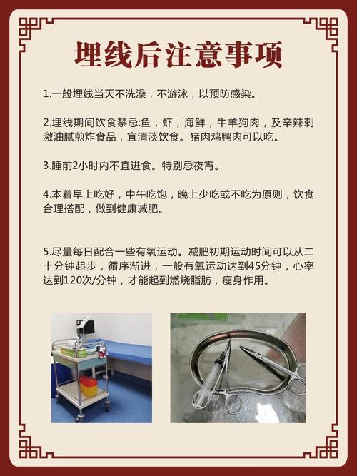 针灸埋线后可以运动吗