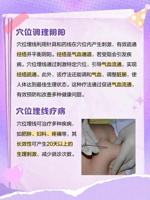 针灸埋线后可以运动吗