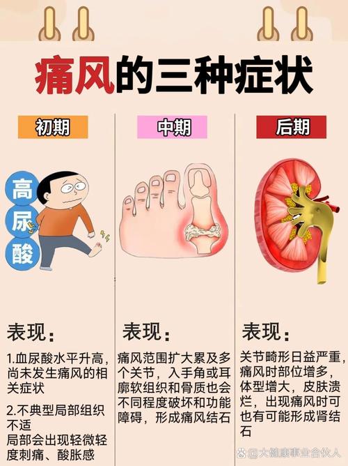 痛风会引起手脚麻木吗