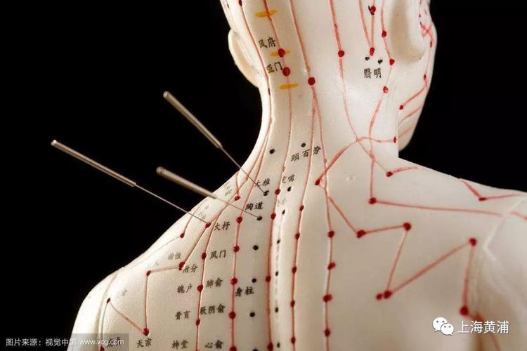 过敏性咳嗽针灸管事吗