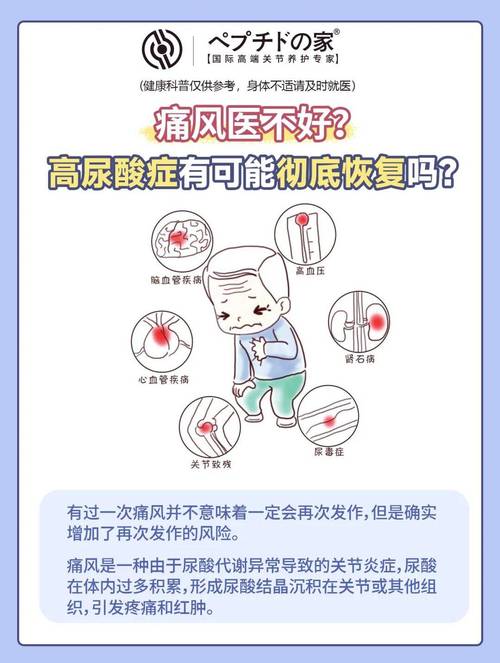 痛风患者尿酸一定高吗