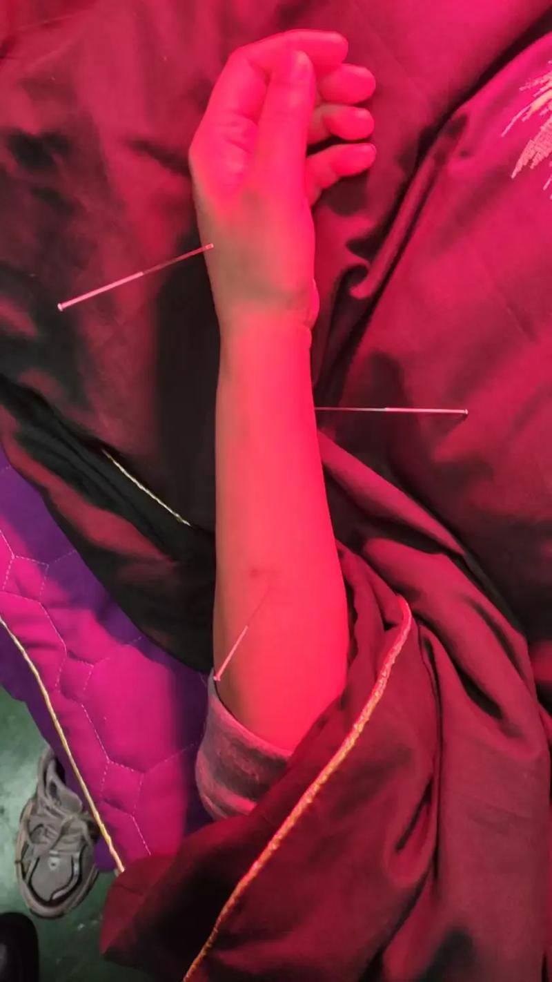 临沂比较好的针灸中医