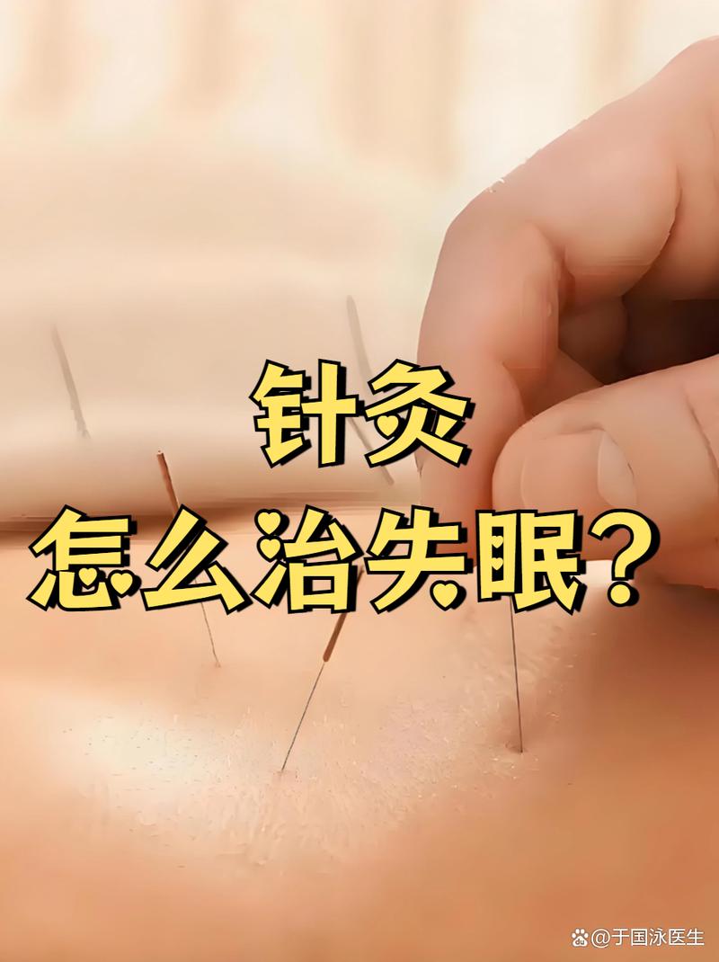 针灸拔罐去失眠哪个好