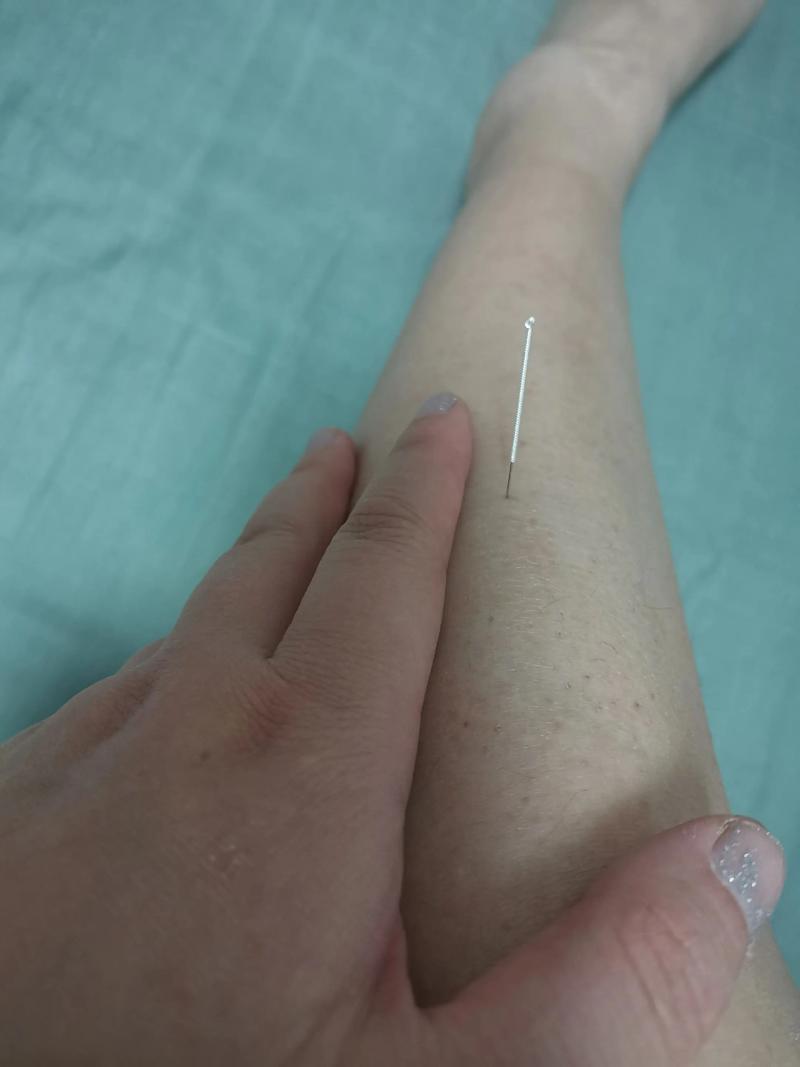 尿酸高脚肿可以针灸吗