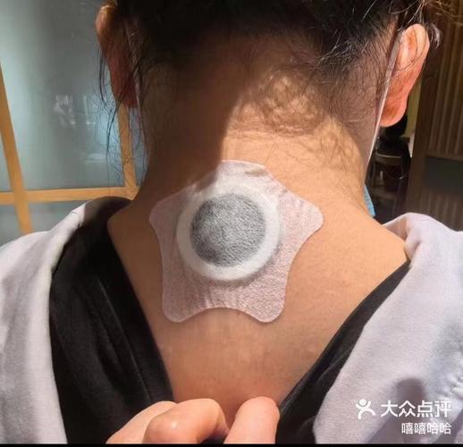 贴针灸效果到底怎么样