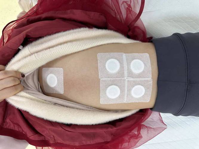 贴针灸效果到底怎么样