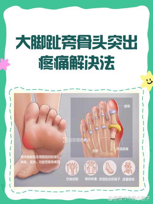 脚趾头痛风可以按摩吗