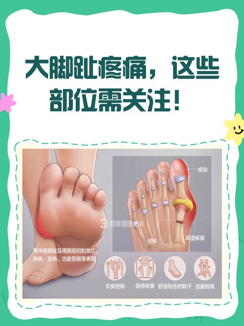 脚趾头痛风可以按摩吗