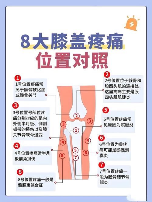 膝关节痛风症状有哪些