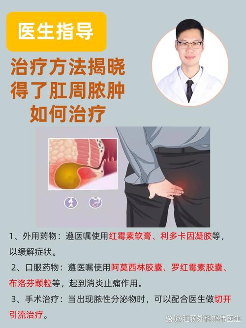 肛周脓肿针灸能治好吗