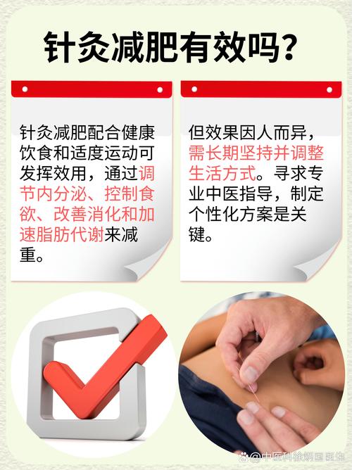 新康的张医生针灸减肥