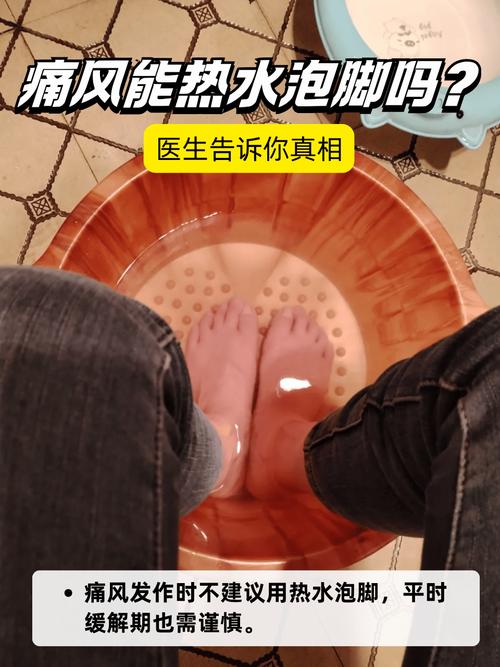 痛风发作时可以用热水