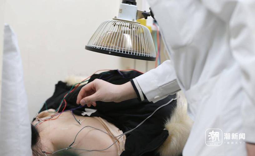 针灸可以调节内分泌吗