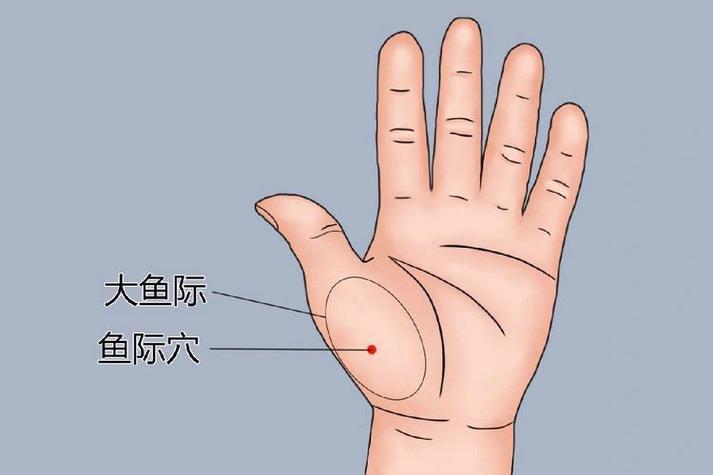 针灸大鱼际治疗打呼噜