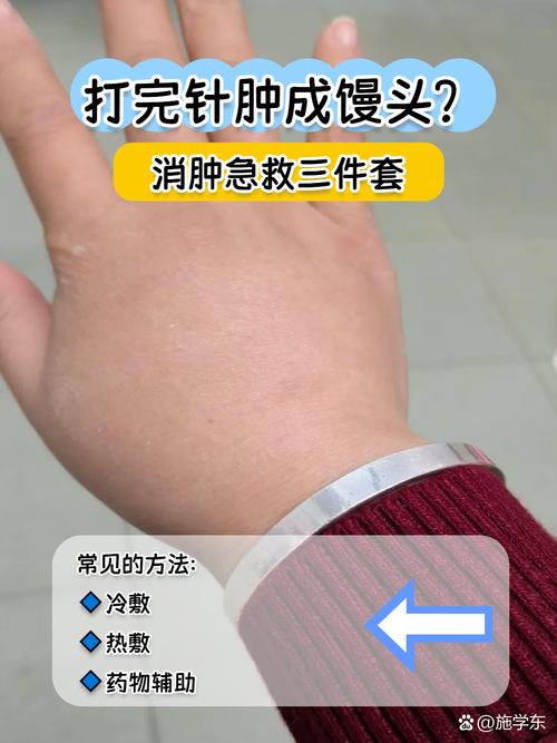 针灸后肿胀怎么回事啊