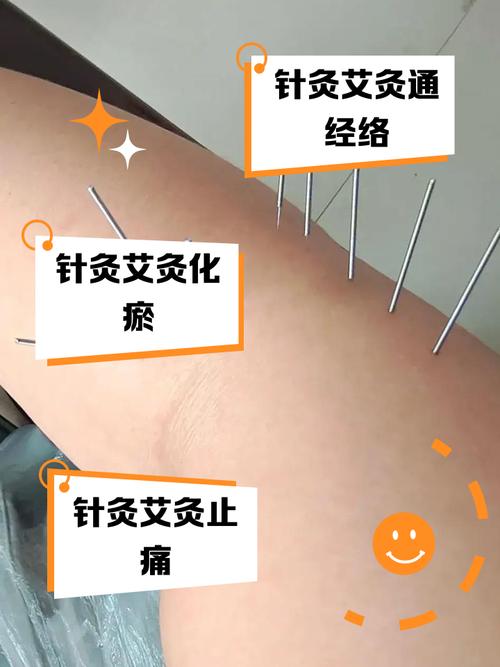 针灸加艾灸效果怎么样