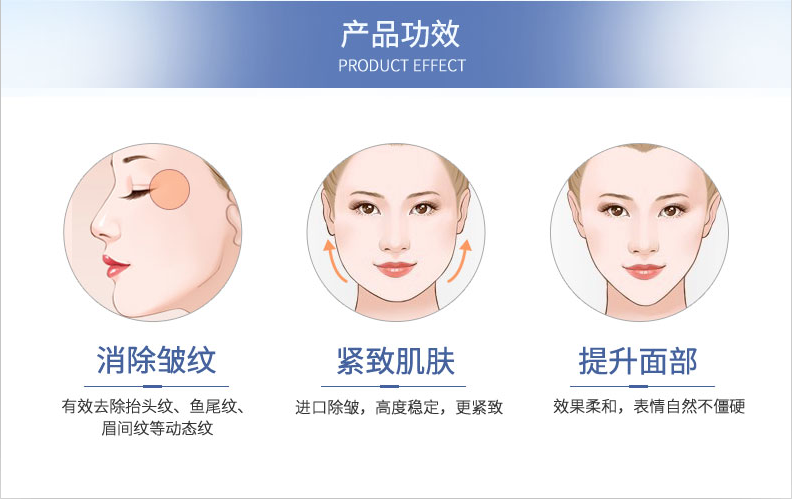 botox祛鱼尾纹安全