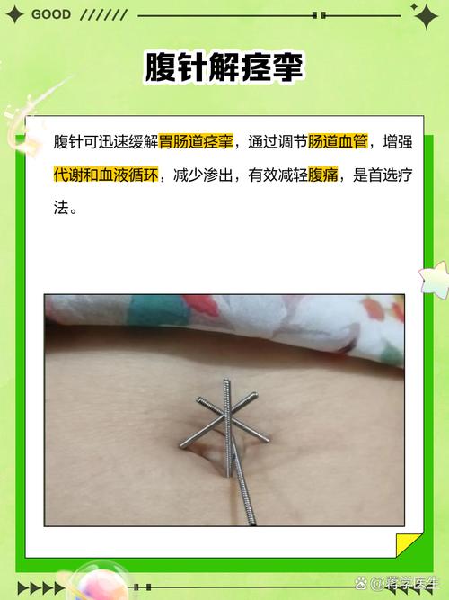 胰腺炎可以针灸治疗吗