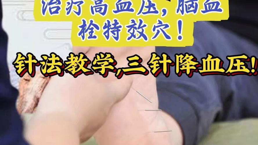 脑梗尿失禁针灸管用吗