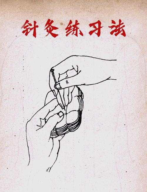 中指发麻用针灸怎么治