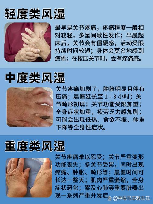 痛风和类风湿有关系吗