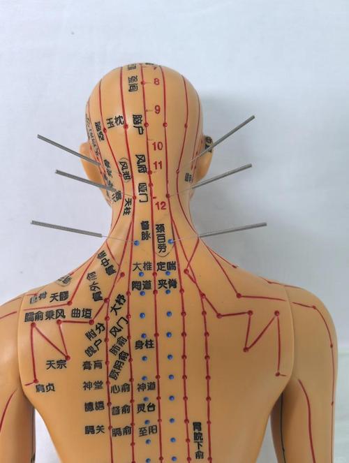 颈椎病针灸多久能治好