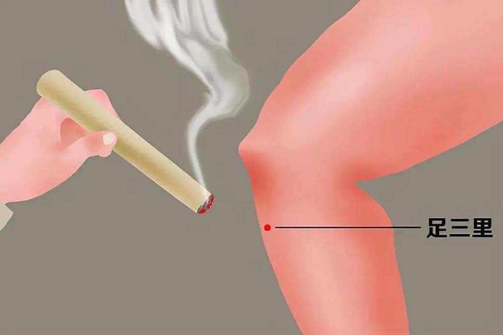 针灸足三里尿频尿量大