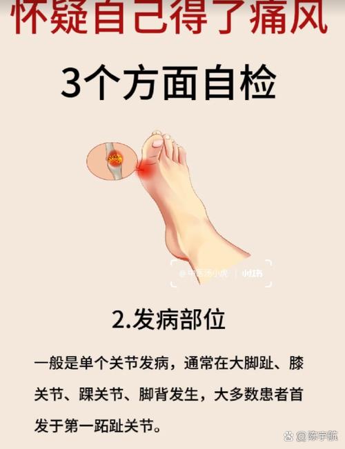 痛风导致膝盖疼怎么办