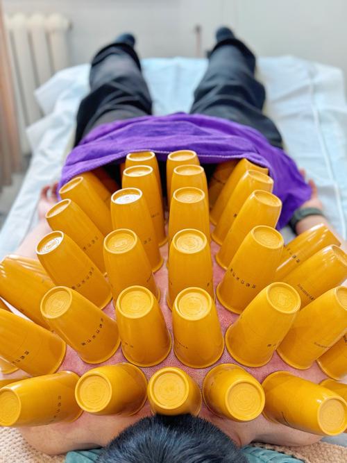 谷世喆瘦针灸怎样使用