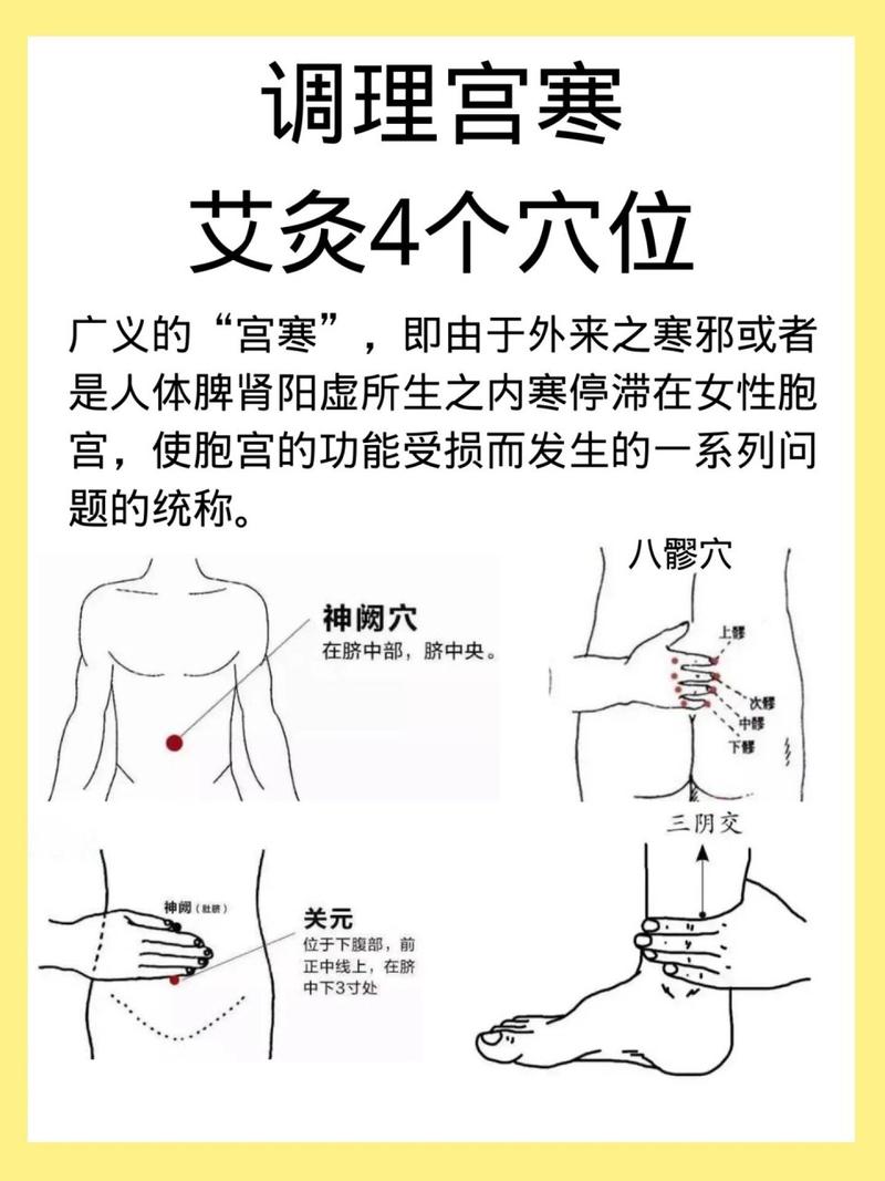 宫寒针灸好还是艾灸好