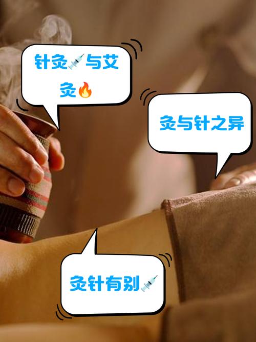 宫寒针灸好还是艾灸好