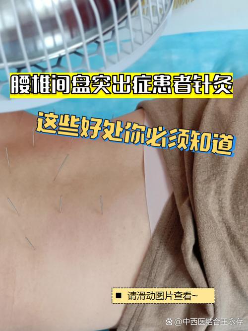 腰椎间盘膨出针灸没用