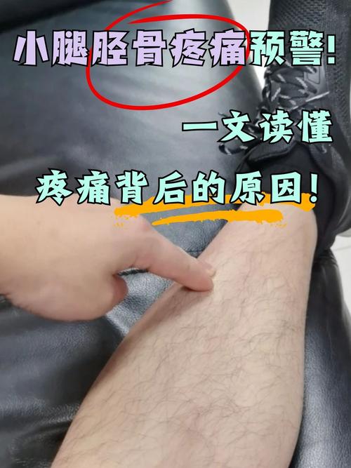 小腿扎针灸后疼为什么