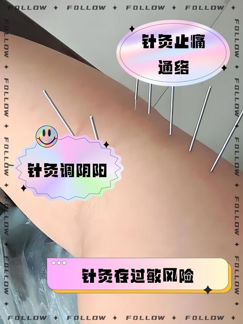 儿童扎针灸有副作用吗