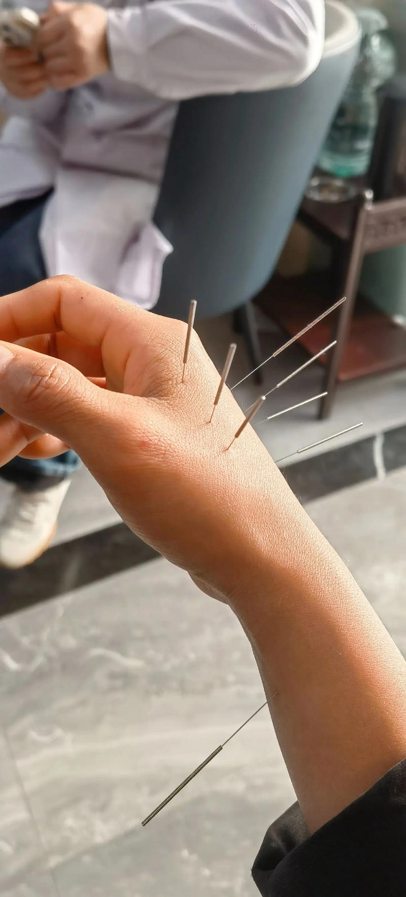 萧山哪里有针灸老中医