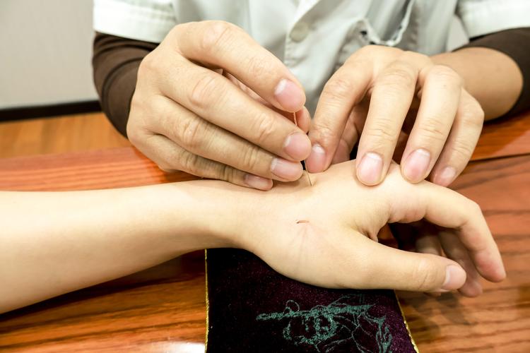 萧山哪里有针灸老中医