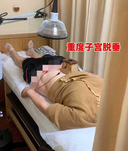 针灸治疗子宫内膜增厚